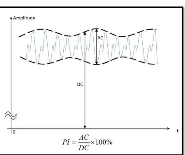 Figure 1.3 Formula of Perfusion Index   