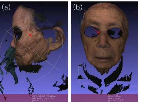 Fig. 5.1.3 (a) 3D camera images of AK 03 patient’s lesion. The location of AK is marked with a red arrow
