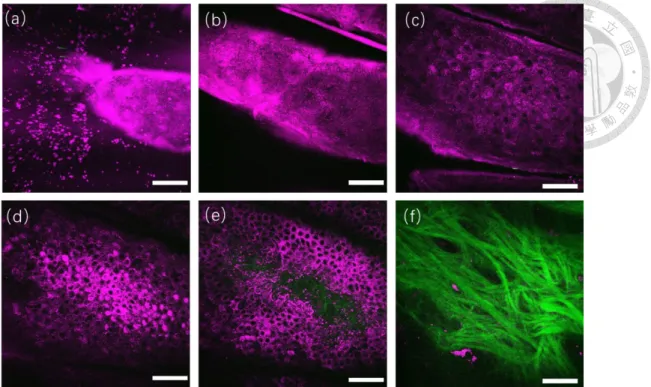 Fig. 5.2.1 [(a) to (f)] A representative series of in vivo HGM images at different depths relative to the surface (5.4,  14.4, 30.6, 52.2, 75.6 and 111.6 μm)