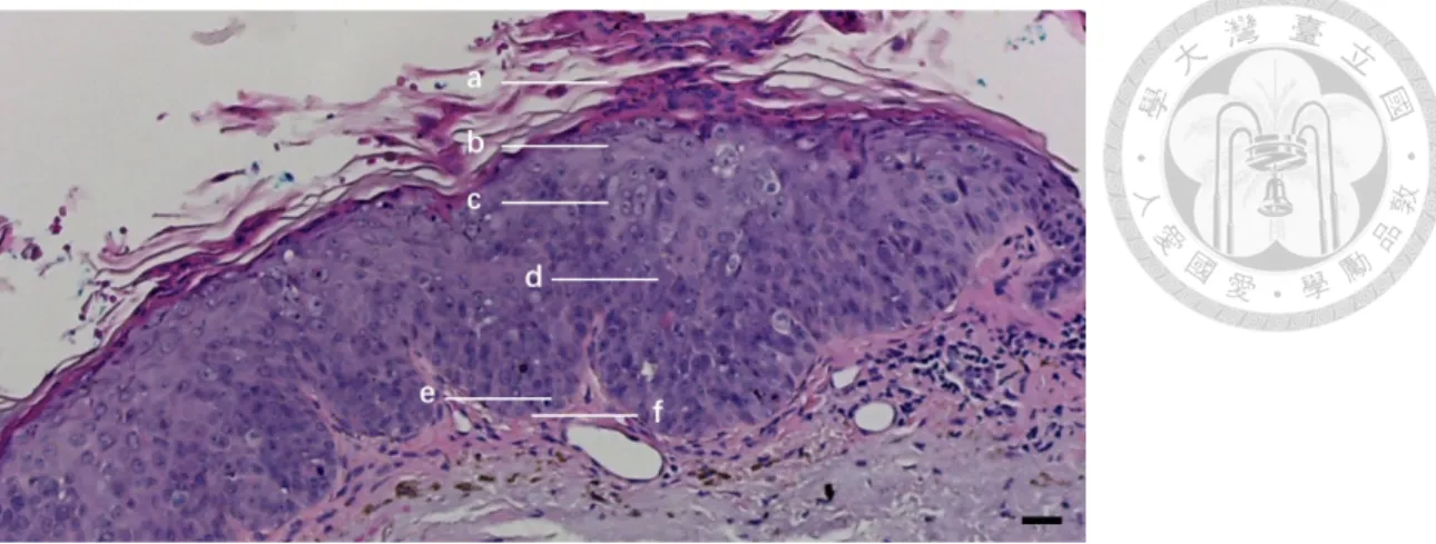 Fig. 5.2.2.1 A transverse histopathology section of the AK patient 00 on the skull. Lines a, b, c, d, e and f represent  depths in the epidermis corresponding to en face sections in Fig