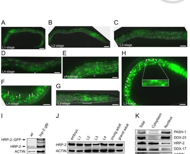 Figure 24.  PASH-1 DDX-23 ACTINHRP-2 DDX-17