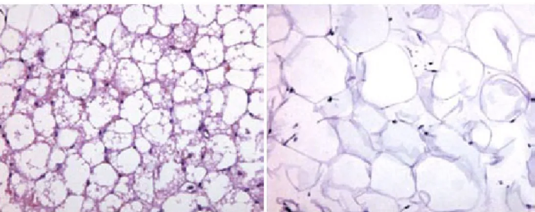 Figure 3. Brown adipose tissue (left) and white adipose tissue (right). 