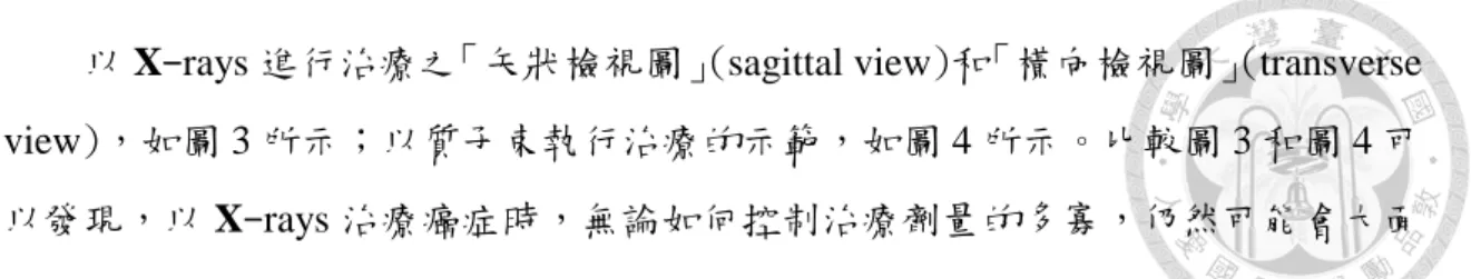 圖 4 以質子束進行放射治療之矢狀視圖和橫向視圖  (資料來源：Proton Therapy Center, 2014) 