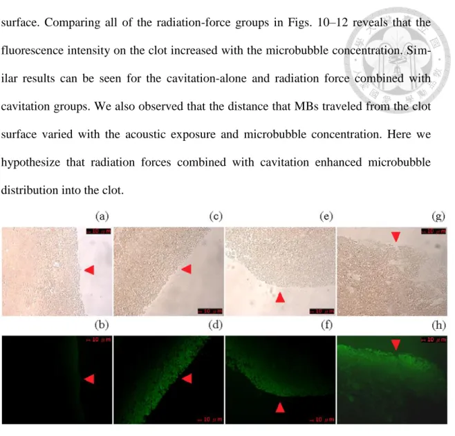 Fig. 10. Confocal microscopy photographs of blood clots. Upper and lower rows are in color and FITC 