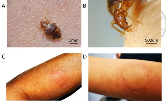 Figure  9    Biting  behavior  of  bed  bug  and  allergy  reaction  after  biting.  (A)  dorsal  view of female Cimex hemipterus was sucking blood; (B) close-up view of proboscis and  stylets; (C) erythema showed on bitten area; (D) the bitten area was sw