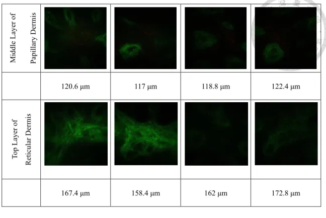 Fig. 4.9    En face skin image of Case E100-I90-1 (a) Glycerol-1 (b) Glycerol-2 (c) Control- Control-1 (d) Control-2