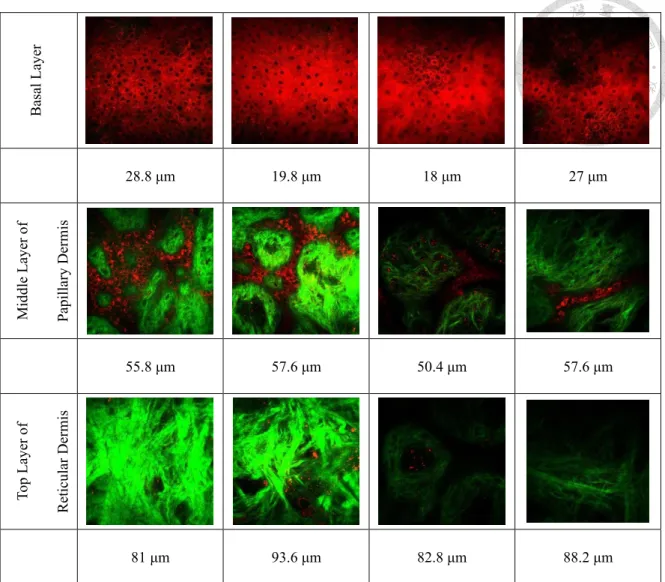 Fig. 4.13    En face skin image of Case E50-I90-1 (a) Glycerol-1 (b) Glycerol-2 (c) Control- Control-1 (d) Control-2