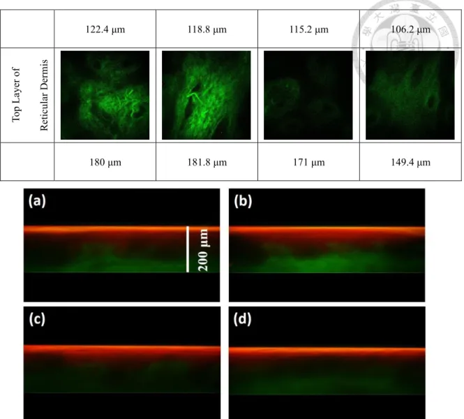 Fig. 4.14    En face skin image of Case E50-I90-2 (a) Glycerol-1 (b) Glycerol-2 (c) Control- Control-1 (d) Control-2
