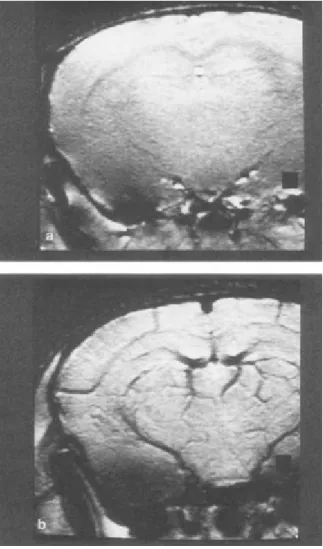 圖 2-10  老鼠吸純氧(a)和正常空氣(b)腦部 MRI 影像[23] 