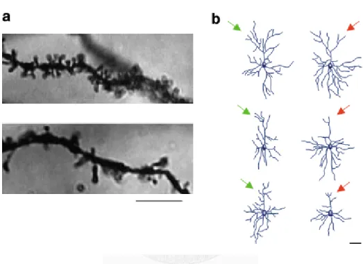 Figure 1 Image visualized by Golgi staining showing how stress alters neuroplasticity,  which then affects the dendritic structure, length, and complexity