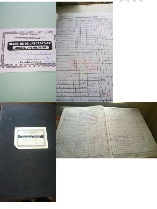 Figure 4. Cameroon TB laboratory and treatment registers  