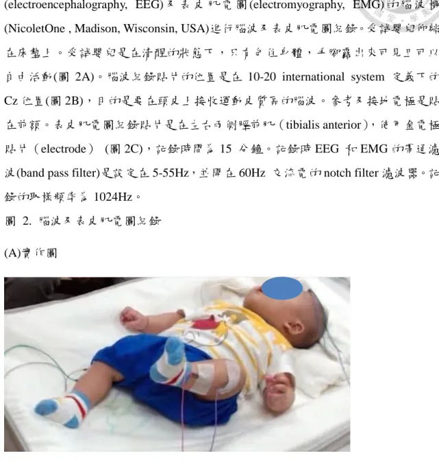圖  2.  腦波及表皮肌電圖紀錄  (A)實作圖 
