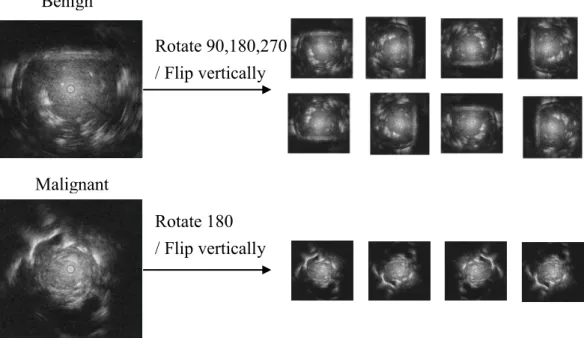 Fig. 3-2. Data augmentation. 