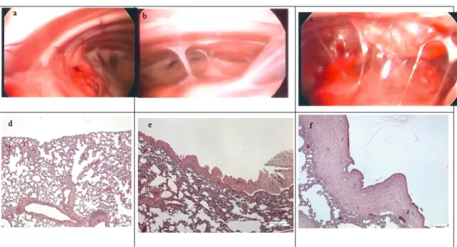 FIGURE 7. (A, B, C)The hemithorax 30 days after various thoracoscopic pleurodesis procedure