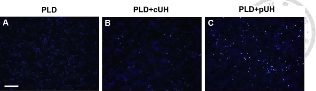 Figure 2-8. TUNEL staining was used to detect apoptotic cells in tumor tissues. Mouse  brains were implanted with 4T1-luc2 tumor cells and the treatments  were performed 6  days after tumors implanted