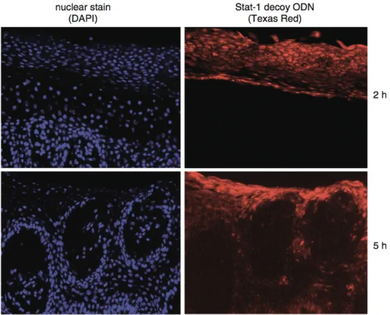 Figure  1.2  Fluorescence  microscopic  image  that  demonstrates  the  uptake  of  a  Texas  Red-labelled  Stat-1  decoy  ODN  into  the  human  skin  cells  (red)