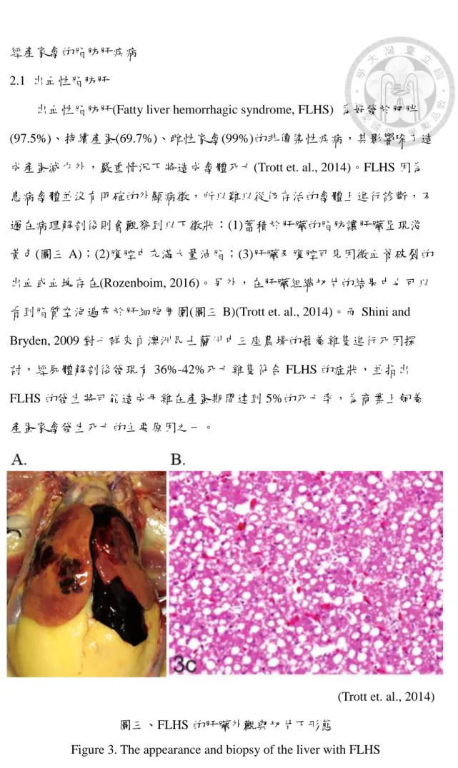 Figure 3. The appearance and biopsy of the liver with FLHS   