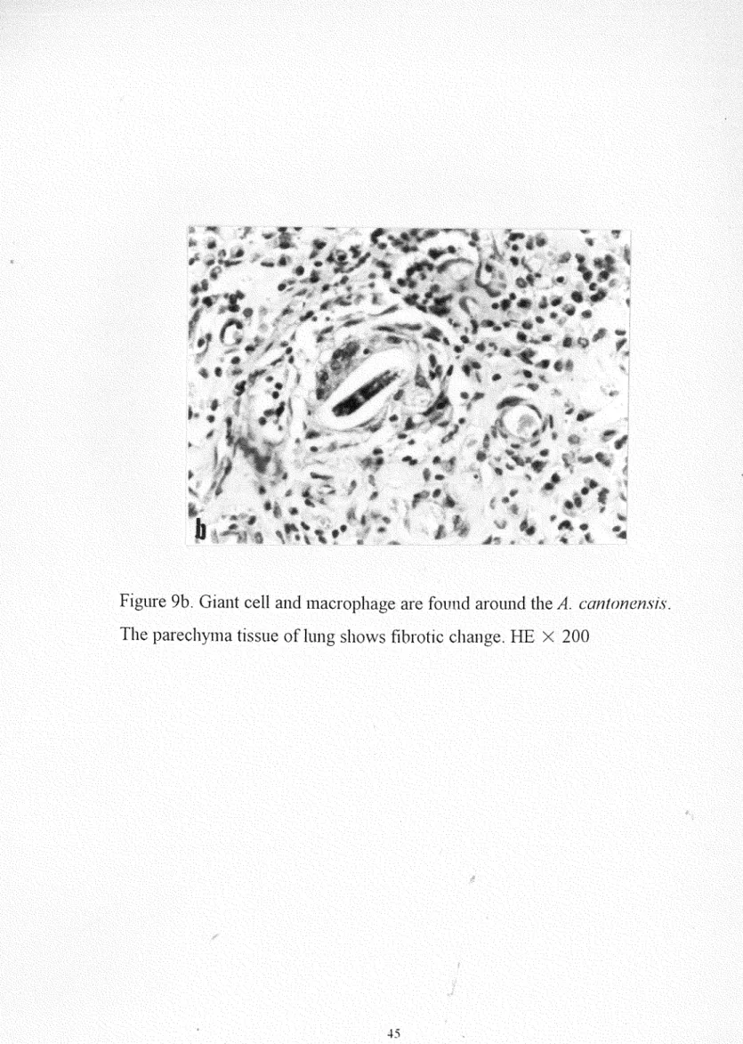 Figure 9b.  Giant cell  and macrophage are found  around the  A.  cantonensis. 