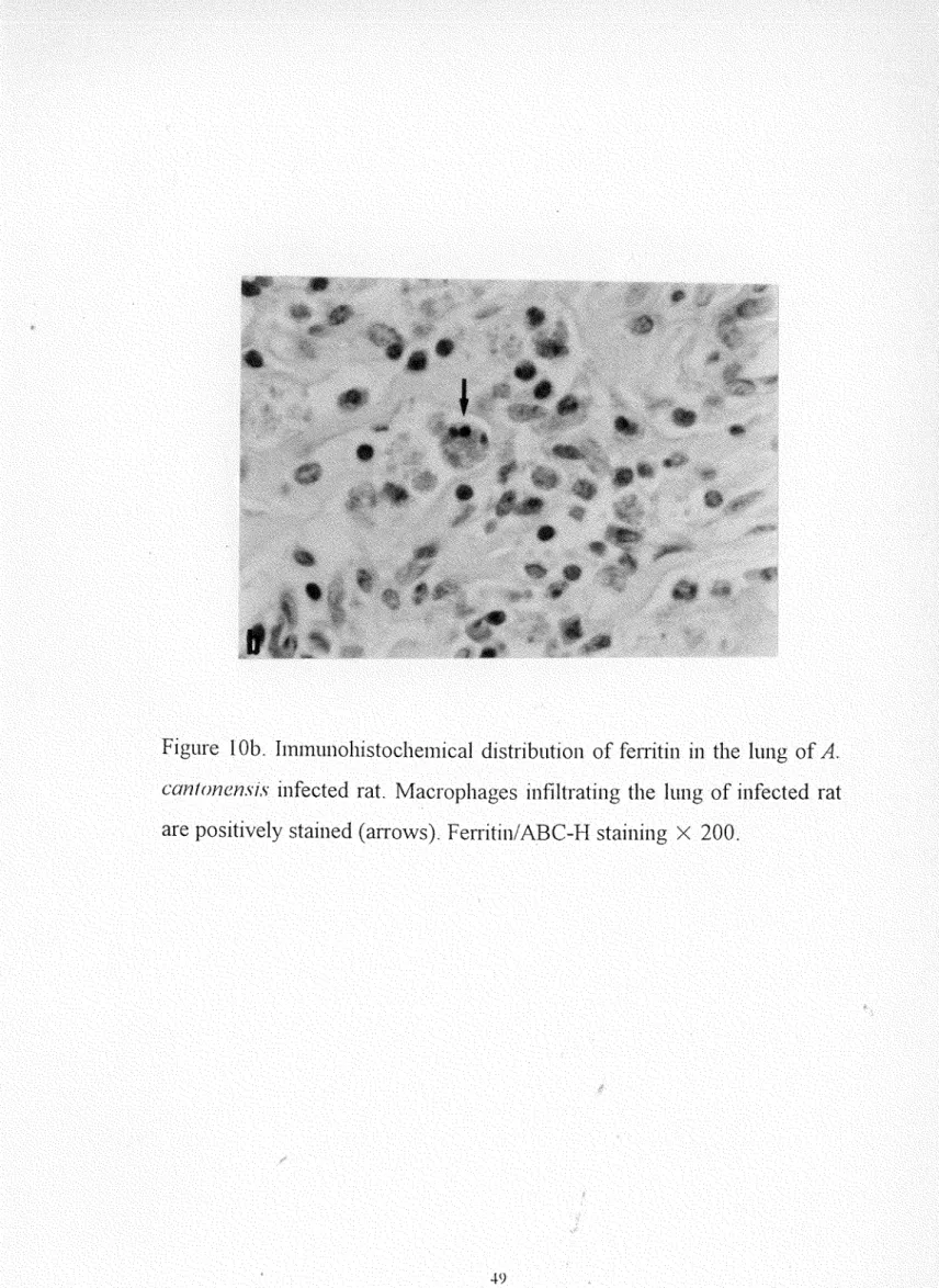 Figure  10b.  lmmunohistochemical  distribution  of fenitin  in  the  lung  of  A. 