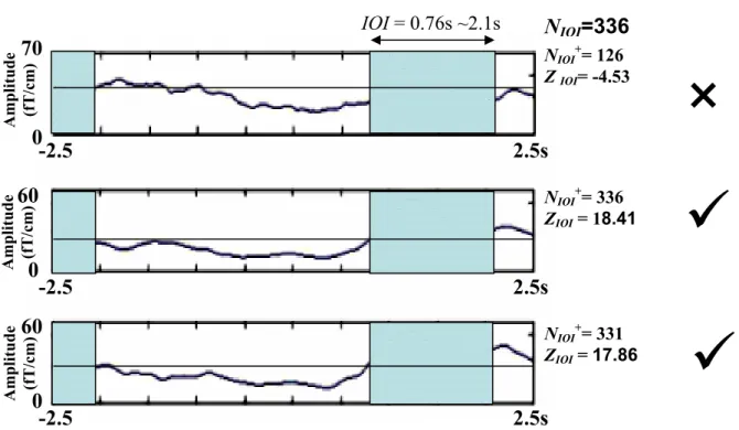 Figure 4. Example of single-trial epoch selection based on a nonparametric sign test.  IOI = 0.76s ~2.1s  -2.5                                                                                  2.5s  -2.5                                                      
