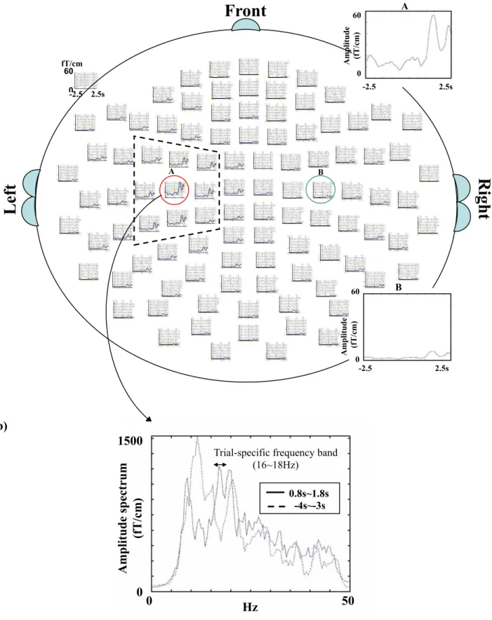 Figure 6. Sensor-array display of VAMW recon s and VAMWs.  (a)  Front 60 A  Amplitude   (fT/cm)  fT/cm  60  0 -2.5                              2.5s  0-2.5  2.5s  A  B R ig h t Left  60 B  Amplitude  0 (fT/cm)  -2.5                              2.5s  (b)  