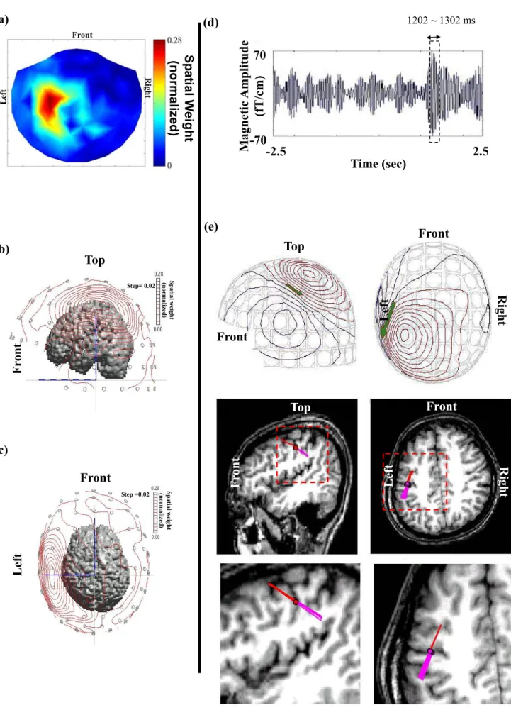 Figure 8. Overlay of extracted reactive beta activities on MR image.  (a)  (b)  (c)  Front  Top  Spatial weight (normalized) Step= 0.02  Magnetic Amplitude  (fT/cm)  70 -70 -2.5 2.5Time (sec) Left  Left  Front Left RightFront Spatial Weight (normalized)  1