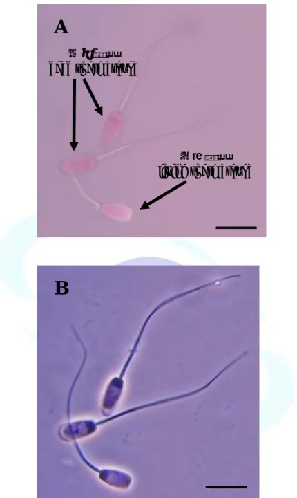 Fig. 1. Micrograph of boar spermatozoa stained with eosin and nigrosin  stain ( A ). The dead spermatozoa stained red, the living spermatozoa  did not stain