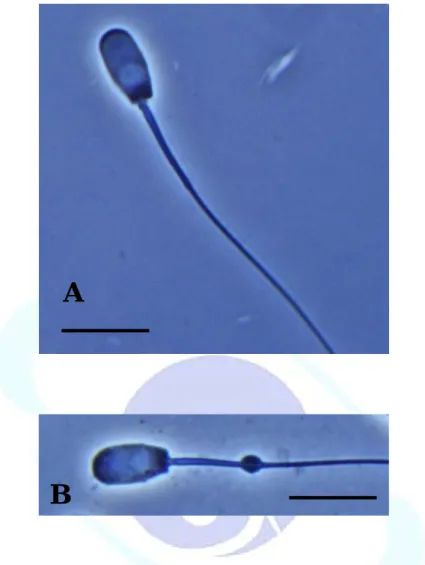 Fig. 2. Micrograph of matured (A) and unmatured (B) spermatozoa. The  spermatozoa were treated with BF3 fixatives, (A) the spermatozoa  without cytoplasmic droplet; (B) the spermatozoa with attached  cytoplasmic droplet