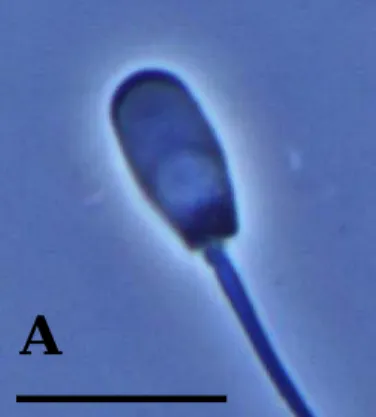 Fig. 3. Micrograph of various acrosome morphology. Spermatozoa were  treated with BF3 fixatives, (A) the spermatozoa with intact  acrosome; (B) the spermatozoa with damaged acrosome; (C) the  spermatozoa without acrosome