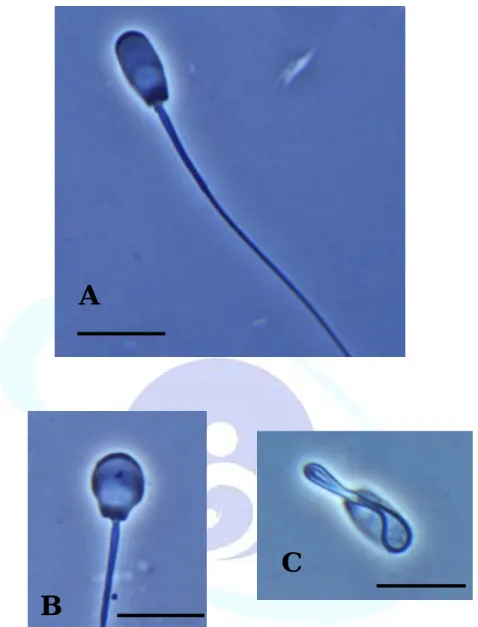 Fig. 4. Micrograph of various spermatozoa morphology. Spermatozoa  were treated with BF3 fixatives, (A) the spermatozoa with  normal morphology; (B) the spermatozoa with abnormal head; 