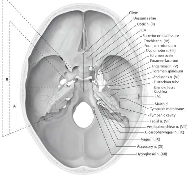 Fig. 11.1  The Fisch-described infratemporal fossa approach has three variations providing a graded level of anterior  and medial exposure
