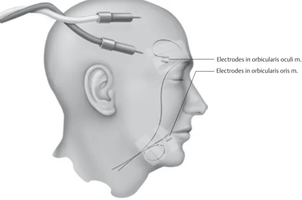 Fig. 6.2  Skin incision.
