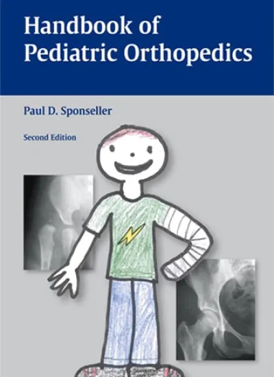 Handbook Of Pediatric Orthopedics - Second Edition