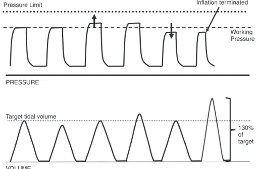 Fig. 10.10   Basic principle of volume guarantee ventilation. The upper panel shows the peak inflation pressure  (PIP) and the lower panel the tidal volume (V T )