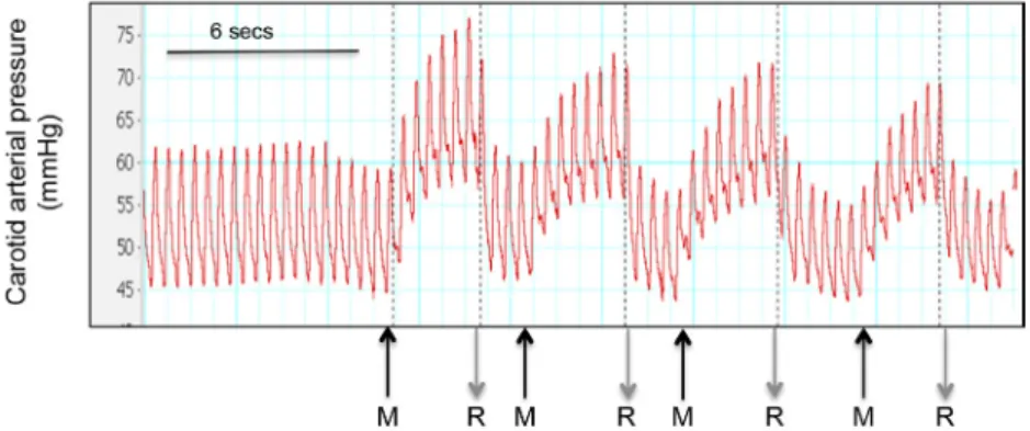 Fig. 1.7   Changes in carotid arterial pressure in response to four consecutive umbilical cord “milkings.” Each  cord milk is indicated “M,” whereas the cord release that occurred at the end of each milk is indicated by “R.” 
