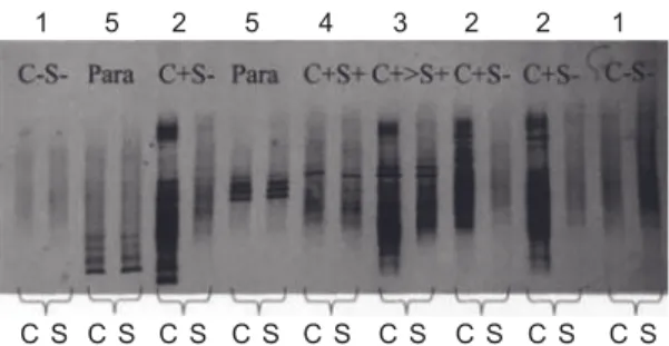 Figure 1.1.       IEF immunoblots of the fi ve consensus patterns of  various CSF and serum isoelectric focusing patterns for local/
