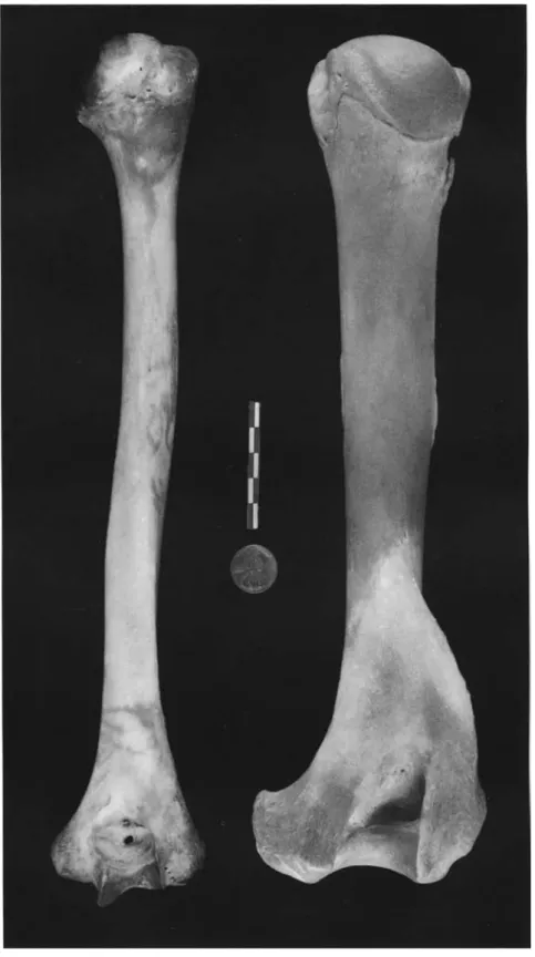 Fig. 4-02. A humanright humerus (posterior view) is compared to a bear's right humerus (caudal view).