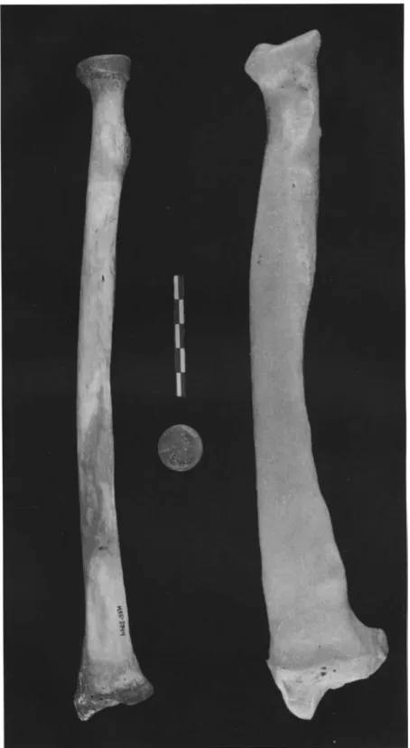 Fig. 4-03. A human right radius (anterior view) is compared to a bear 's right radius (caudal view).