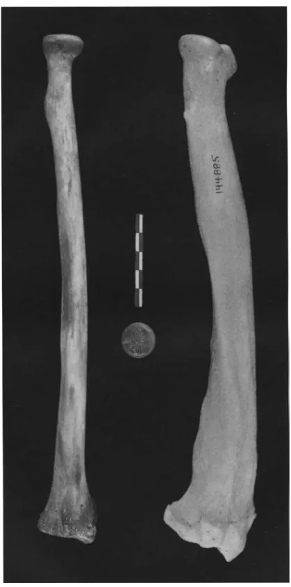 Fig. 4-04. A human right radius (posterior view) is compared to a bear's right radius (cranial view).