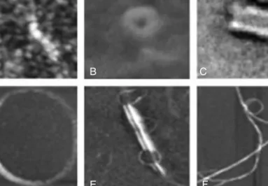 FIGURE 1.3 Morphologies of globular, proto ﬁ brillar, and ﬁ brillar amyloid aggregates