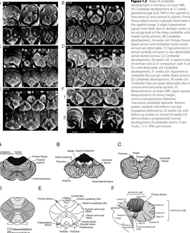 Figure 1.5 Steps of cerebellar development in the fetus on brain MRI.