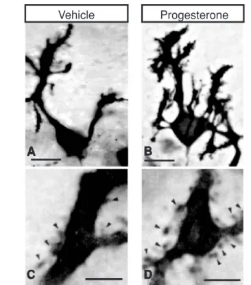 Figure 1.18 Top panels: dendritic growth and spinogenesis in response to