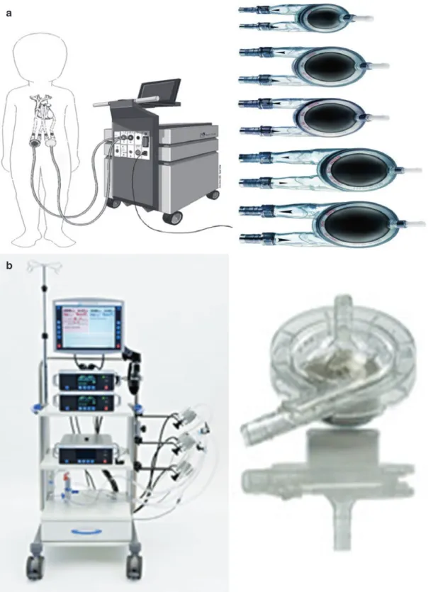 Fig. 6.2  Mechanical assist devices. (a) Berlin Heart  EXCOR biventricular support and console with varying  sizes of pumps