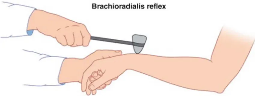 Fig. 4.14 Brachioradialis reflex. The arm is held in flexion at the elbow a little less than 90° and pronated halfway
