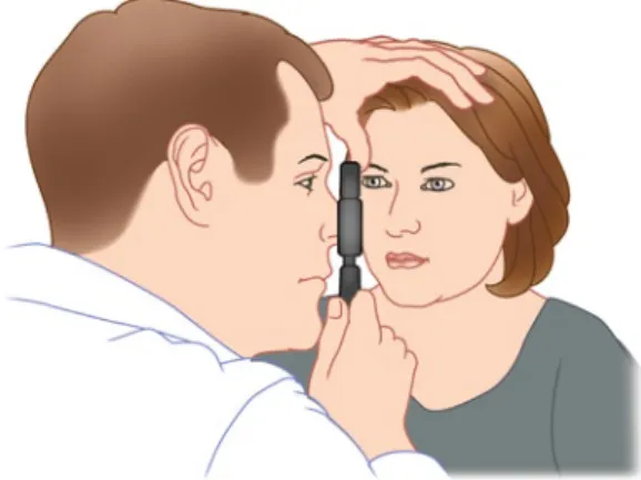 Fig.  4.1 Ophthalmoscopic  examination.  The  examiner  should be close enough to touch the patient’s cheek with a  finger holding the ophthalmoscope