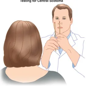 Fig. 4.2 Testing for a central scotoma with a red-tipped  match. Each eye is tested alone with the patient focused  on the match placed on the examiner’s nose