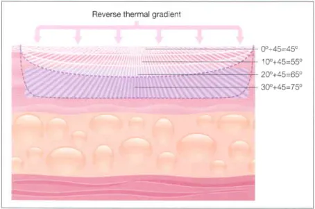 Fig. 4.2 Reverse  thermal gradient created via simultaneous  cooling of the epidermis  and heating  of the dermis