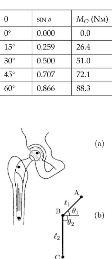 Fig. 3.19 Total hip joint prosthesis