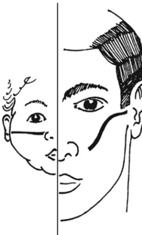 Figure 3.2  Diagram to show the angle of the Eustachian tube in the infant and the adult state the middle ear is signifi cantly less effective in conducting sound to the  inner ear