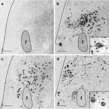Fig.  1  Hypocretin  and  MCH  expression  studies  in  the  hypothalamus  of  control  and  narcoleptic  subjects